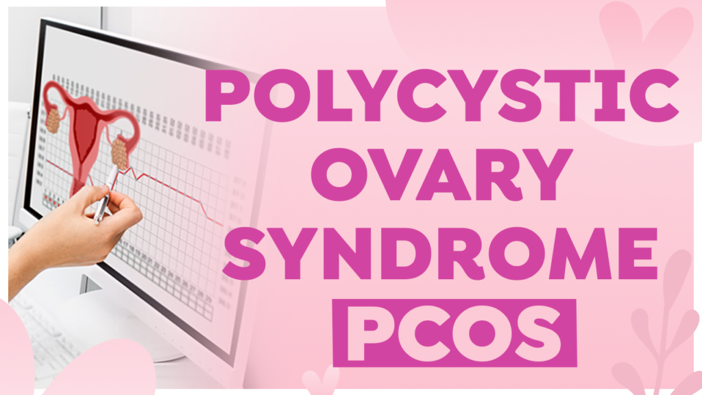 Polycystic Ovary Syndrome (PCOS)